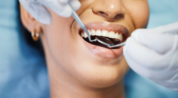 Best Emergency Broken Tooth Repair in Akron, CO